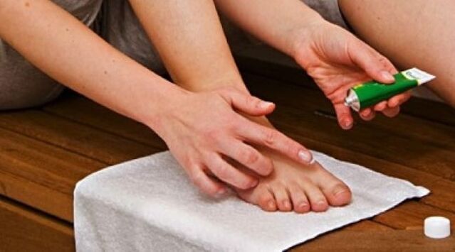 лечение на гъбички на ноктите на краката с мехлем